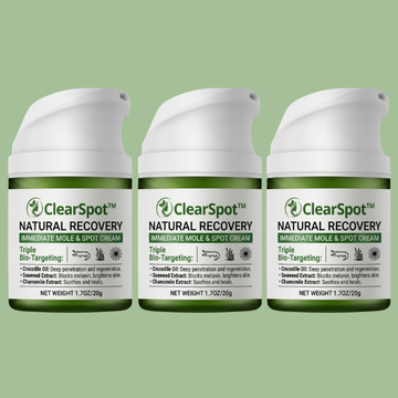 ClearSpot™- kräm | Eliminerar åldersfläckar och leverfläckar på 36 timmar — Innan din självkänsla dör