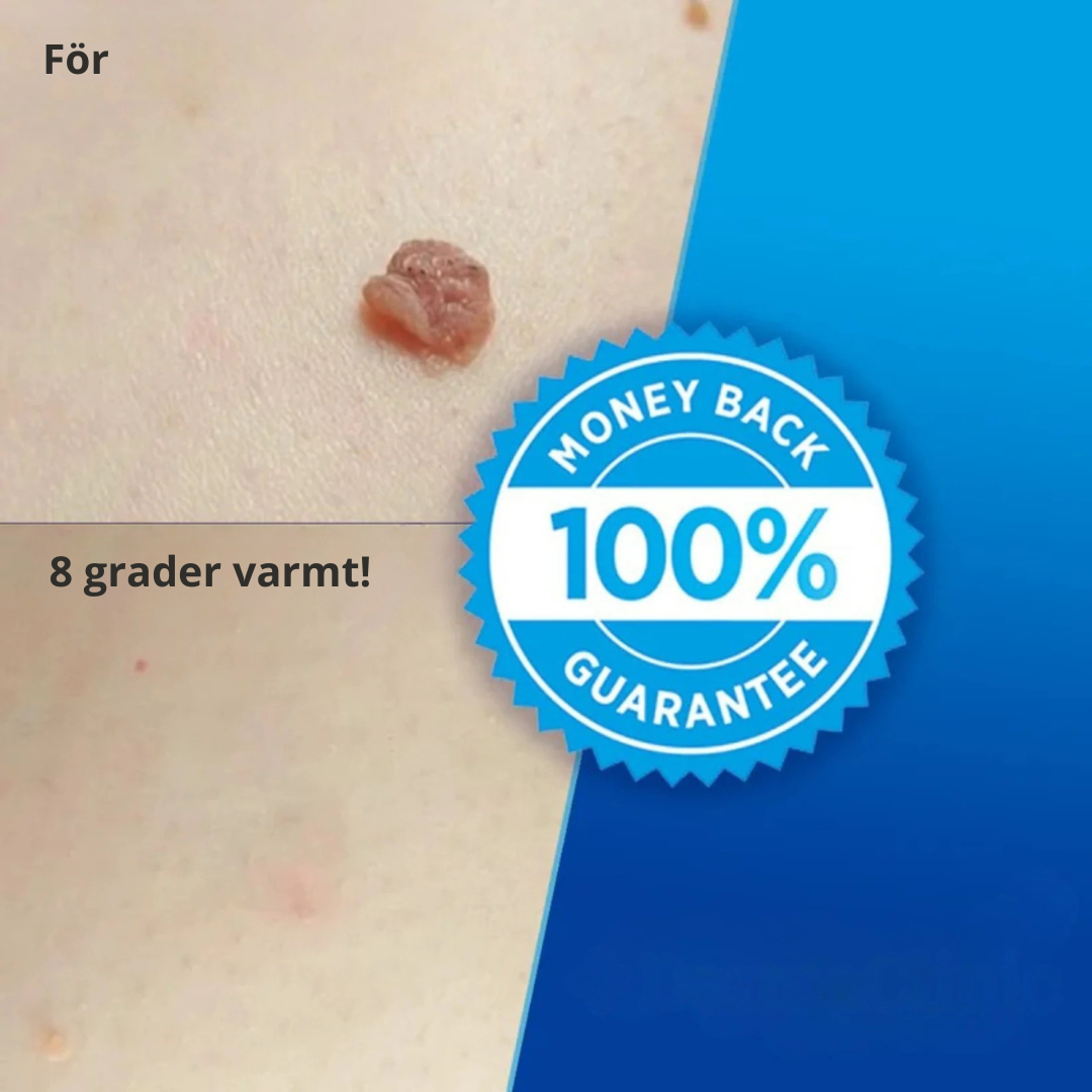 Hudlättare™ - Bärbar Sugapparat För Hud